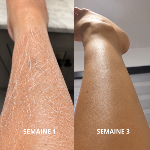 Virelau Magic 100ml — Fini la peau sèche.