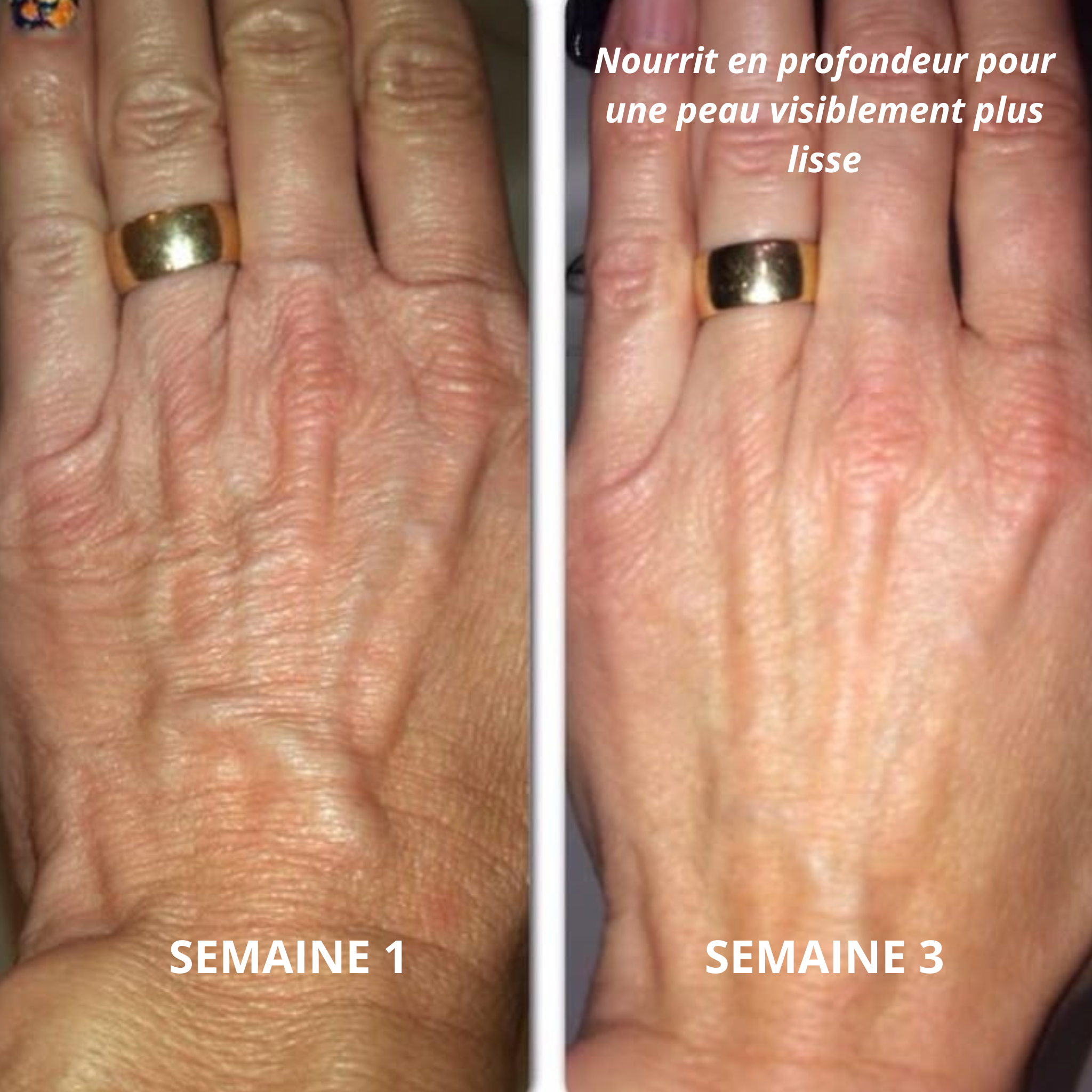 Virelau Magic 100ml — Fini la peau sèche.