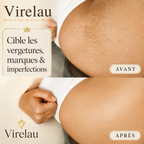 Huile Corps de Luxe Virelau – Nutrition Intense pour Peaux Sèches