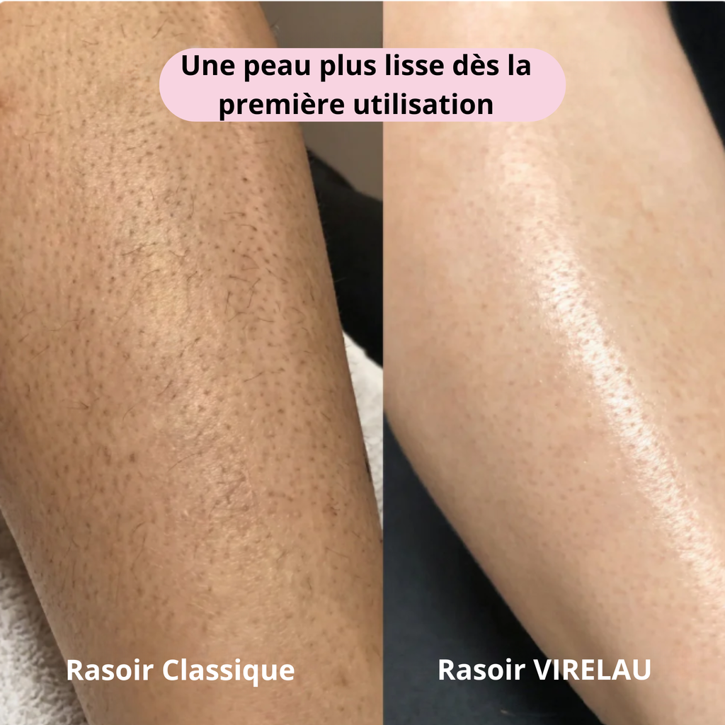 Rasoir VIRELAU - Fini les coupures et les irritations