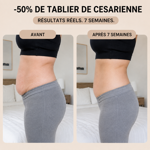 Culotte Gainante Post-Partum — Compression 360°