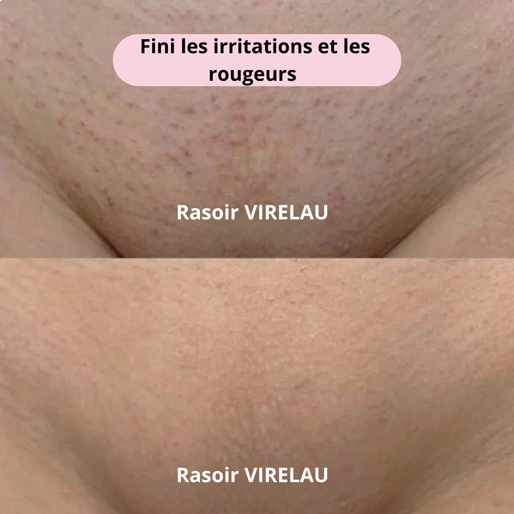 Rasoir VIRELAU - Fini les coupures et les irritations