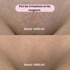 Rasoir VIRELAU - Fini les coupures et les irritations